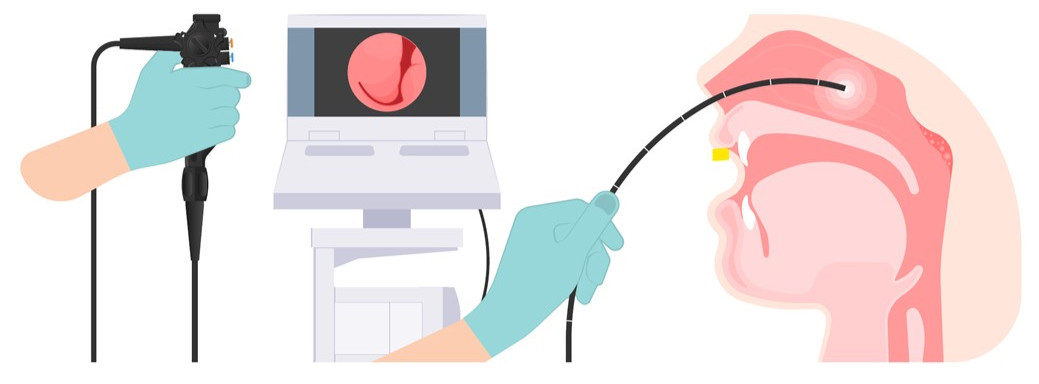 Exame de Videolaringoscopia para Concursos: você sabia que pode ser exigido?